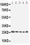 Homeobox A6 antibody, PA1605, Boster Biological Technology, Western Blot image 