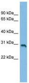 Solute Carrier Family 35 Member E2A antibody, TA334629, Origene, Western Blot image 
