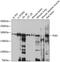 Phospholipase B antibody, A08822, Boster Biological Technology, Western Blot image 