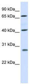 RAD52 Motif Containing 1 antibody, TA339975, Origene, Western Blot image 