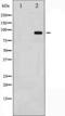 Catenin Beta 1 antibody, TA325397, Origene, Western Blot image 