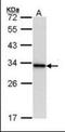Hematopoietic Cell-Specific Lyn Substrate 1 antibody, orb89950, Biorbyt, Western Blot image 