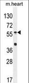 Sp8 Transcription Factor antibody, LS-C161414, Lifespan Biosciences, Western Blot image 