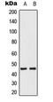 Mitogen-Activated Protein Kinase Kinase 1 antibody, LS-C354253, Lifespan Biosciences, Western Blot image 