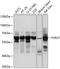 P2X purinoceptor 7 antibody, A01208-1, Boster Biological Technology, Western Blot image 