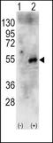 Ribosomal Protein S6 Kinase B2 antibody, TA302019, Origene, Western Blot image 