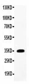 Interleukin 1 Beta antibody, PB9025, Boster Biological Technology, Western Blot image 