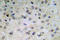 Estrogen Receptor 1 antibody, AP20937PU-N, Origene, Immunohistochemistry frozen image 