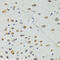 Dicer 1, Ribonuclease III antibody, 19-979, ProSci, Immunohistochemistry frozen image 