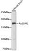 Ras Protein Specific Guanine Nucleotide Releasing Factor 1 antibody, GTX64744, GeneTex, Western Blot image 