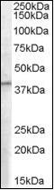 Eukaryotic translation initiation factor 3 subunit M antibody, orb88111, Biorbyt, Western Blot image 