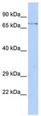 F-Box And WD Repeat Domain Containing 8 antibody, TA330939, Origene, Western Blot image 