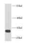 Endonuclease G, mitochondrial antibody, FNab02760, FineTest, Western Blot image 