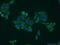 Ribosomal Protein S5 antibody, 16964-1-AP, Proteintech Group, Immunofluorescence image 