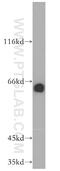 Equilibrative nucleoside transporter 1 antibody, 11337-1-AP, Proteintech Group, Western Blot image 