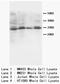 SSX Family Member 2B antibody, AP23257PU-N, Origene, Western Blot image 