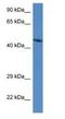 Actin Binding Rho Activating Protein antibody, NBP1-79506, Novus Biologicals, Western Blot image 