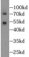MK2 antibody, FNab04998, FineTest, Western Blot image 