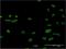 Histone chaperone ASF1B antibody, H00055723-M03, Novus Biologicals, Immunocytochemistry image 