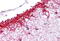 NLR Family Pyrin Domain Containing 14 antibody, MBS244646, MyBioSource, Immunohistochemistry paraffin image 