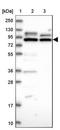 Protein Phosphatase 1 Regulatory Subunit 37 antibody, NBP1-90889, Novus Biologicals, Western Blot image 