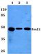 Forkhead box protein E1 antibody, GTX66668, GeneTex, Western Blot image 