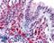 Parkin Coregulated antibody, LS-B127, Lifespan Biosciences, Immunohistochemistry paraffin image 