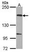 EvC Ciliary Complex Subunit 2 antibody, GTX107725, GeneTex, Western Blot image 