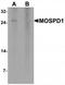 Motile Sperm Domain Containing 1 antibody, TA319964, Origene, Western Blot image 