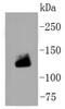 Collagen Type I Alpha 1 Chain antibody, NBP2-67538, Novus Biologicals, Western Blot image 