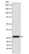Major Histocompatibility Complex, Class II, DR Beta 4 antibody, M02570, Boster Biological Technology, Western Blot image 