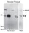 A-Kinase Anchoring Protein 6 antibody, NB300-869, Novus Biologicals, Western Blot image 