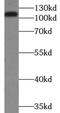 Desmocollin 2 antibody, FNab02344, FineTest, Western Blot image 
