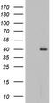 Histone Deacetylase 11 antibody, TA804441, Origene, Western Blot image 
