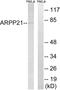 CAMP Regulated Phosphoprotein 21 antibody, LS-C119799, Lifespan Biosciences, Western Blot image 