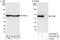Pyruvate Kinase M1/2 antibody, A303-659A, Bethyl Labs, Western Blot image 