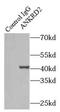 Ankyrin repeat domain-containing protein 2 antibody, FNab00410, FineTest, Immunoprecipitation image 