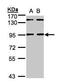 DDB1- and CUL4-associated factor 6 antibody, GTX105954, GeneTex, Western Blot image 