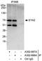 Eyes absent homolog 2 antibody, A302-687A, Bethyl Labs, Immunoprecipitation image 