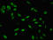 SWI/SNF-related matrix-associated actin-dependent regulator of chromatin subfamily D member 1 antibody, orb401072, Biorbyt, Immunofluorescence image 