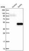 Deoxyhypusine synthase antibody, NBP1-82648, Novus Biologicals, Western Blot image 