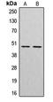 CTSE antibody, LS-C352068, Lifespan Biosciences, Western Blot image 
