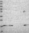 Chromosome 15 Open Reading Frame 62 antibody, NBP1-93538, Novus Biologicals, Western Blot image 