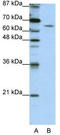 Double-stranded RNA-binding protein Staufen homolog 1 antibody, TA345891, Origene, Western Blot image 