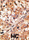 BCL2 Like 11 antibody, abx027202, Abbexa, Immunohistochemistry paraffin image 