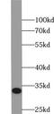 Vanin 2 antibody, FNab09422, FineTest, Western Blot image 