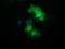 NSE2 (MMS21) Homolog, SMC5-SMC6 Complex SUMO Ligase antibody, LS-C115575, Lifespan Biosciences, Immunofluorescence image 