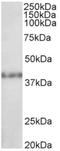 Histone-lysine N-methyltransferase SUV39H2 antibody, AP22371PU-N, Origene, Western Blot image 