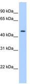 Plasminogen activator inhibitor 1 antibody, TA342383, Origene, Western Blot image 