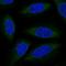 ALG6 Alpha-1,3-Glucosyltransferase antibody, HPA062536, Atlas Antibodies, Immunofluorescence image 